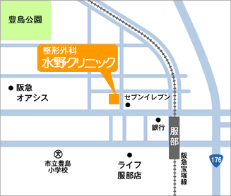 整形外科水野クリニックは阪急服部天神駅徒歩5分です。